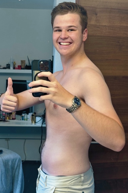 Maximilian Pfeffel - After